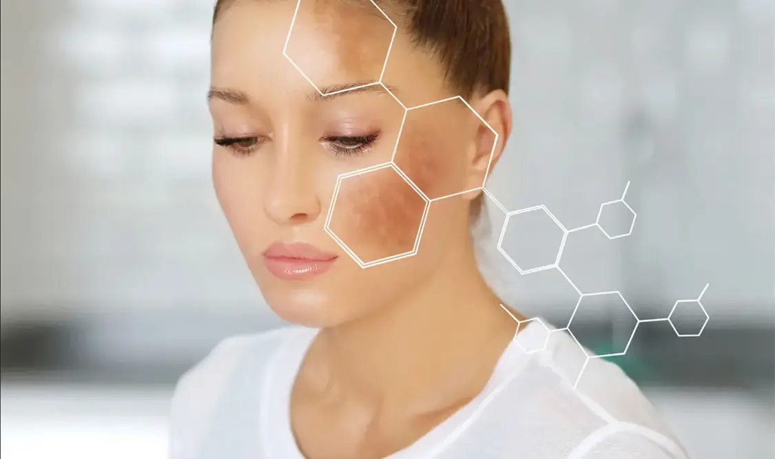 Cómo evitar manchas en la piel