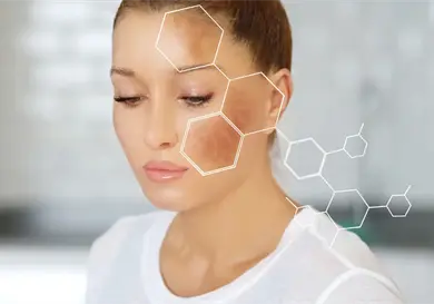 C&oacute;mo evitar manchas en la piel