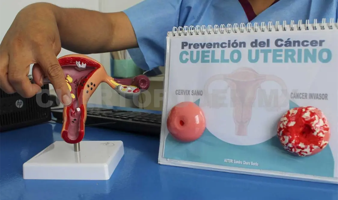 Urge priorizar acciones contra el cáncer