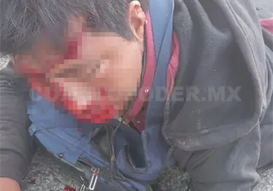 Motociclista sufre accidente sobre el bulevar Laguitos