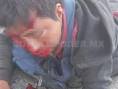 Motociclista sufre accidente sobre el bulevar Laguitos