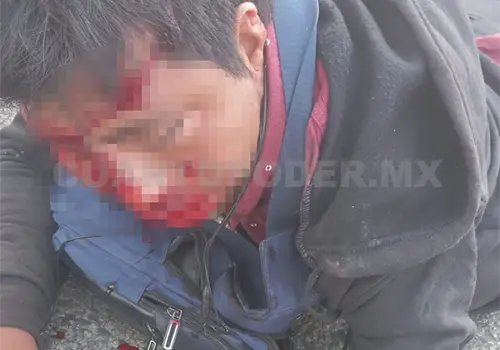 Motociclista sufre accidente sobre el bulevar Laguitos