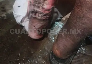 Chiapas en primer lugar por casos de miasis