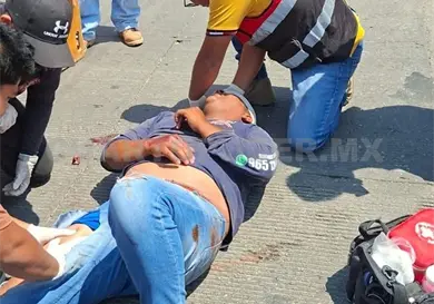 Queda malherido al ser atropellado Queda malherido al ser atropellado