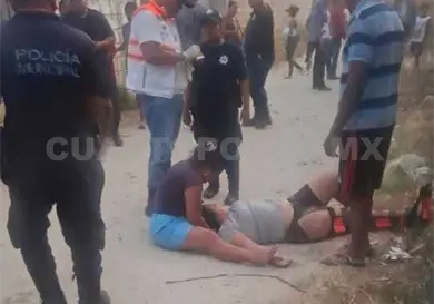 Quedan heridos luego de accidentarse en motocicleta Quedan heridos luego de accidentarse en motocicleta