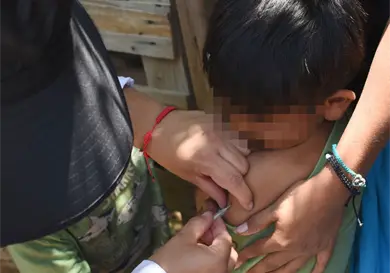 El sarampión va claramente a la baja El sarampión va claramente a la baja