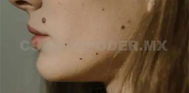 Cuidado con lunares o manchas irregulares