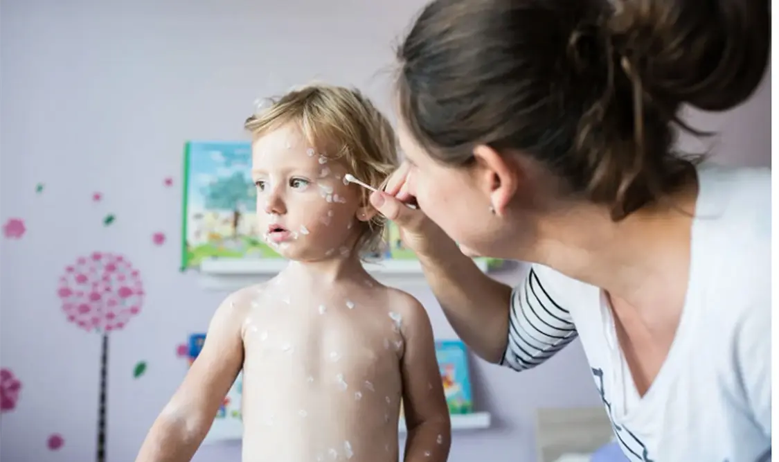 Piel sensible: cuando la crema no ayuda