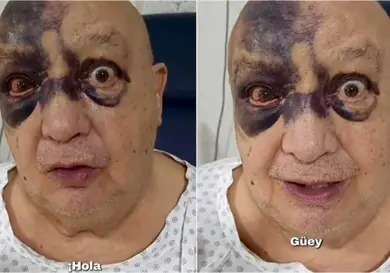 Avanza la recuperación de Luis de Alba Avanza la recuperación de Luis de Alba