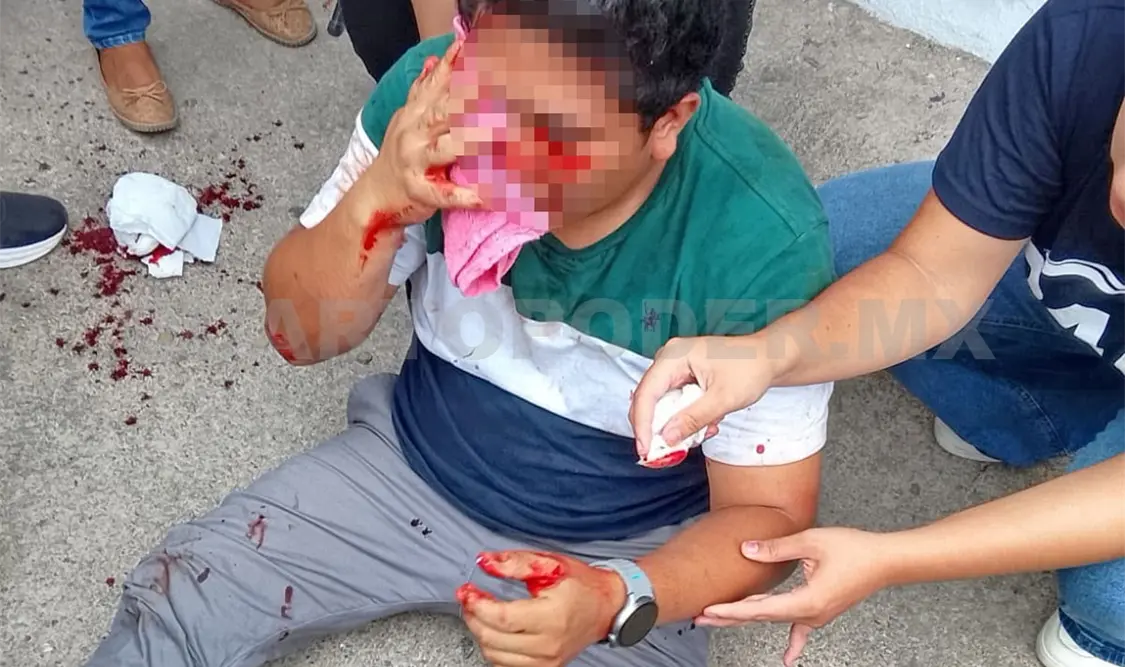 “Lío de faldas” dejó a un joven navajeado y a un detenido. Ulises Villalobos / CP