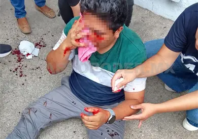 Le navajean el rostro por disputa amorosa