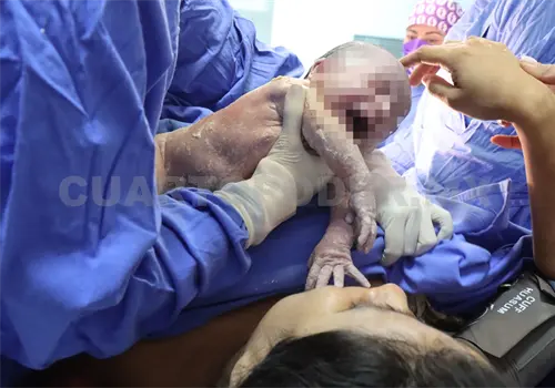 Cardiopatía congénita, riesgo de nacimiento Cardiopatía congénita, riesgo de nacimiento