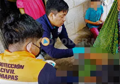 Niño se lastima un pie con machete Niño se lastima un pie con machete