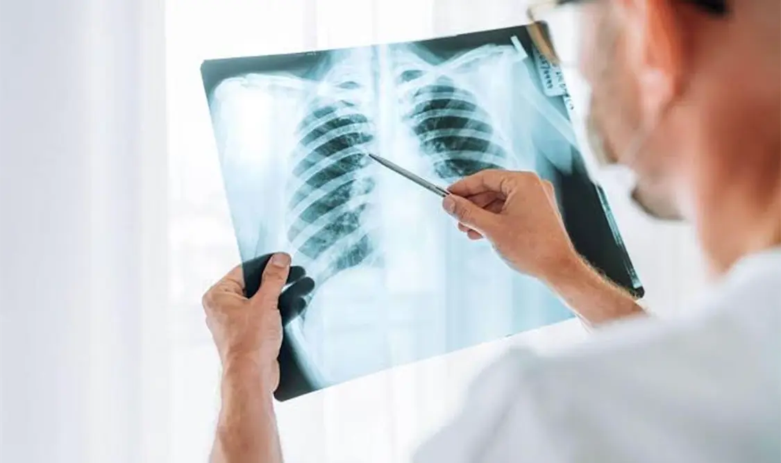 Así puedes prevenir la pulmonía