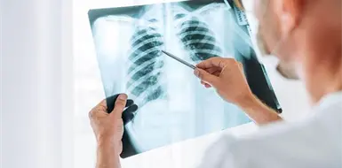 Así puedes prevenir la pulmonía Así puedes prevenir la pulmonía