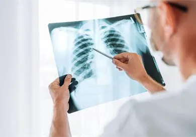 Así puedes prevenir la pulmonía Así puedes prevenir la pulmonía