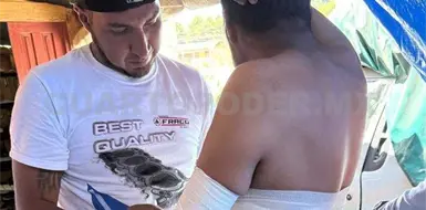 Balconero se quema tras flamazo en taller