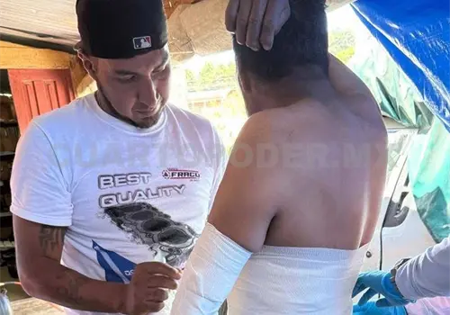 Balconero se quema tras flamazo en taller
