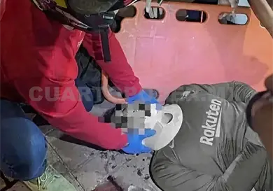 Queda malherido al ser atropellado