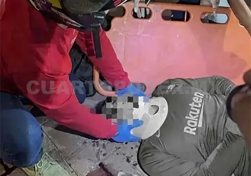 Queda malherido al ser atropellado Queda malherido al ser atropellado