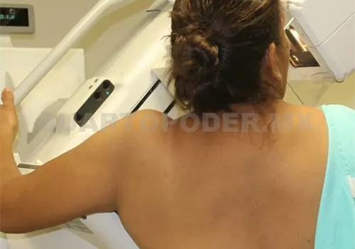 Medicina preventiva, la m&aacute;s efectiva contra el c&aacute;ncer