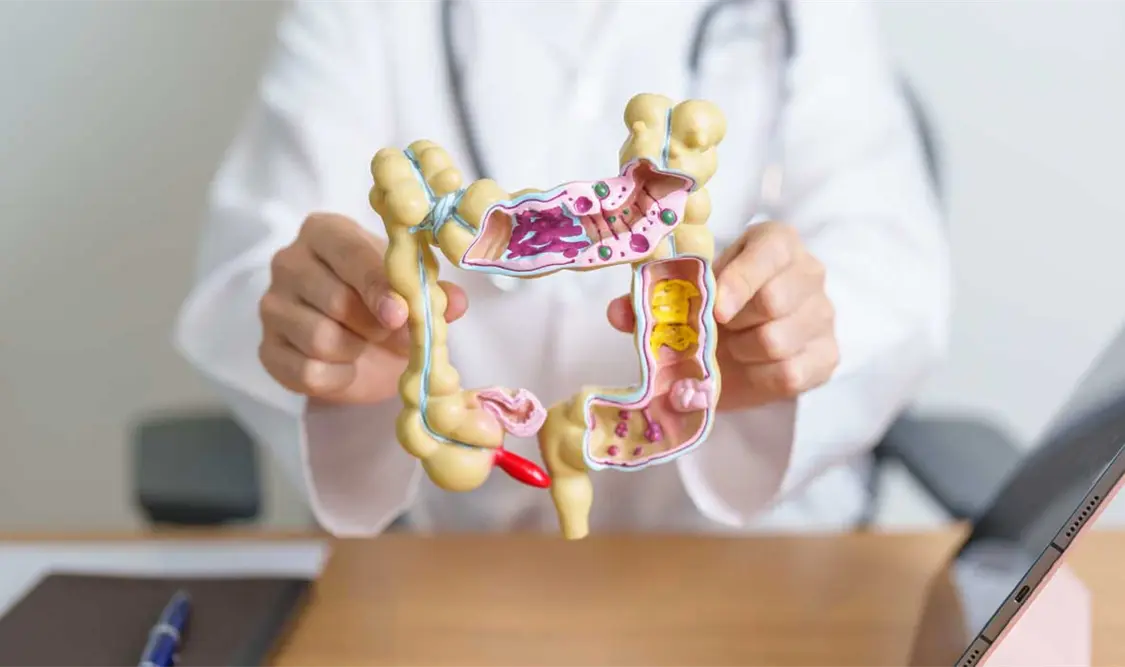 Cuida tu intestino y mejora tu calidad de vida