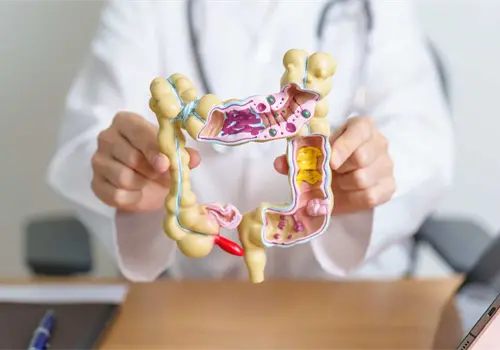 Cuida tu intestino y mejora tu calidad de vida