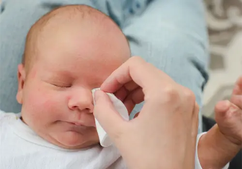 Conjuntivitis: c&oacute;mo reconocerla y cuidarla