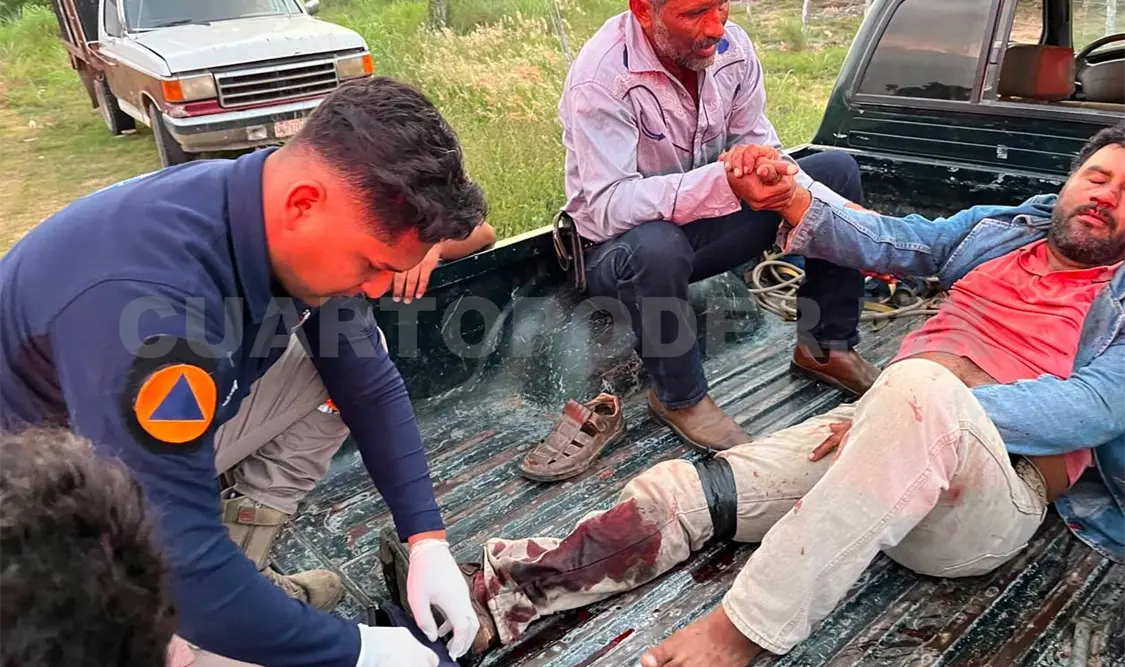 Un torniquete colocado por los lugareños ayudó a frenar el sangrado hasta el arribo de los paramédicos. Osman Toledo / CP