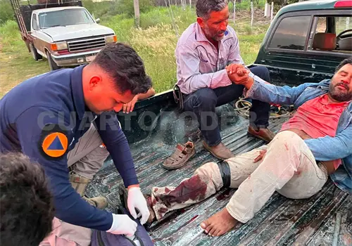 Se fractura un tobillo al accidentarse en moto Se fractura un tobillo al accidentarse en moto