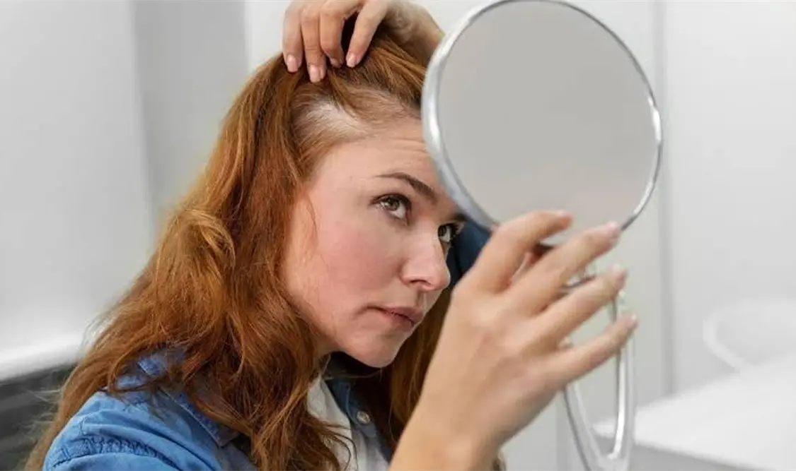 ¿Cómo prevenir la caída del cabello?