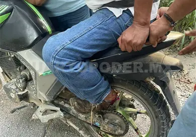 Casi pierde un pie por la cadena de su moto Casi pierde un pie por la cadena de su moto