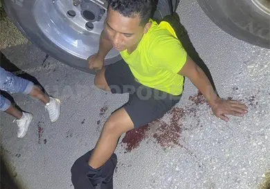 Balean a talachero en una pierna