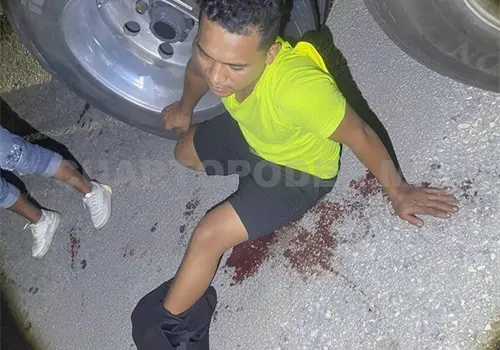 Balean a talachero en una pierna