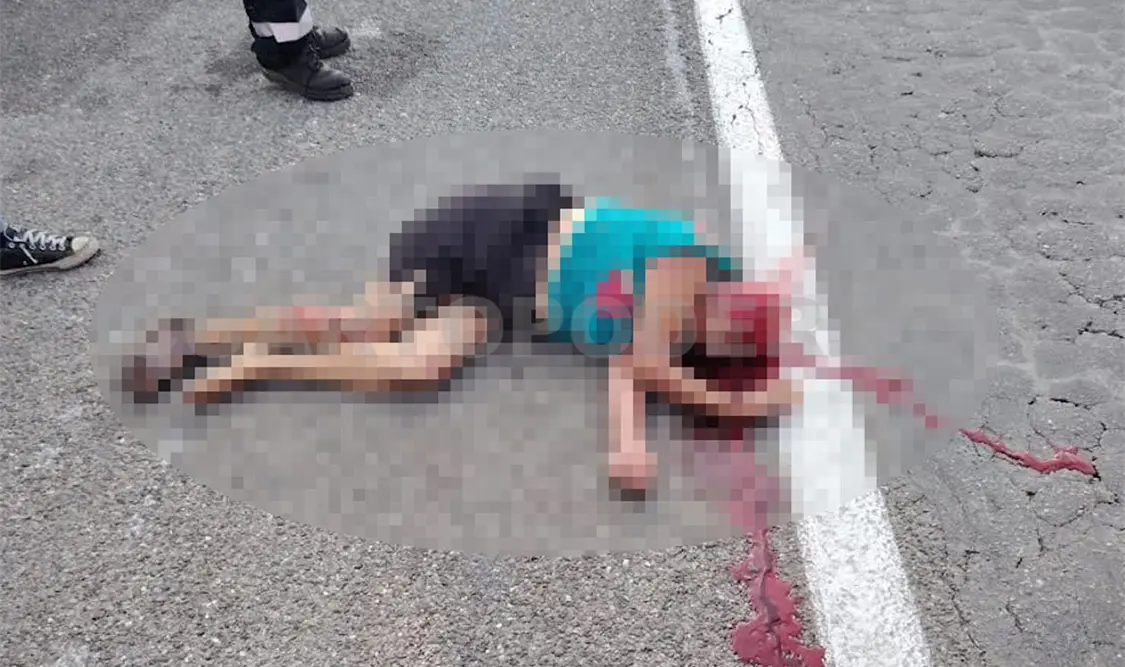 La mujer fue brutalmente embestida y su cuero cabelludo arrancado de raíz. Ulises Villalobos / CP