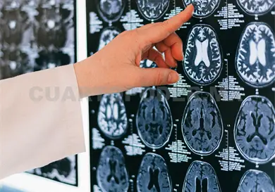 Conmemoran D&iacute;a Mundial de la Par&aacute;lisis Cerebral