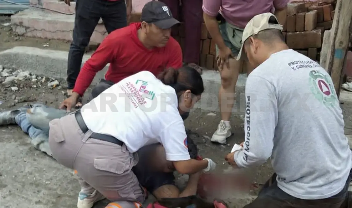 Paramédicos de Protección Civil se presentaron para valorar la gravedad de las lesiones. CP
