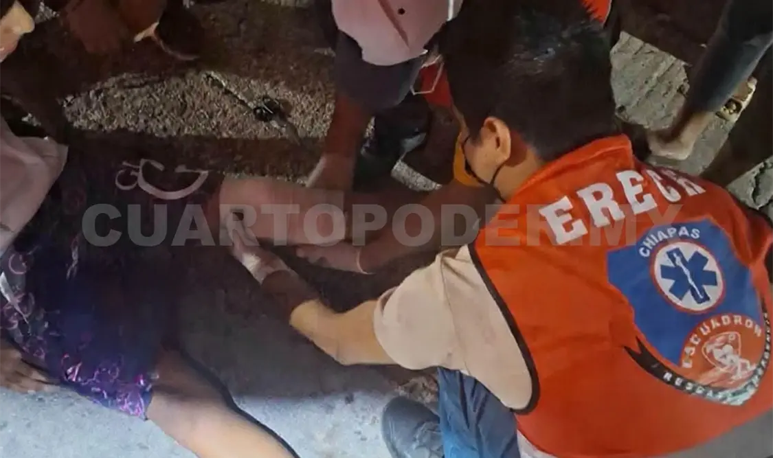 El motorista tenía laceraciones, abrasiones y una posible luxación en la rodilla izquierda. CP