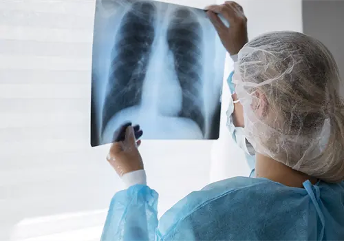 ¡Cuida tus pulmones! ¡Cuida tus pulmones!